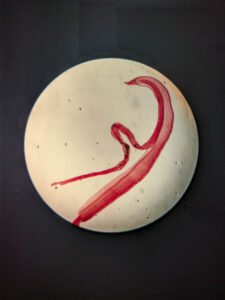Diagnostic Breakthrough: How Laboratory Larval Development Confirmed Rare Parasitic Brain Infection