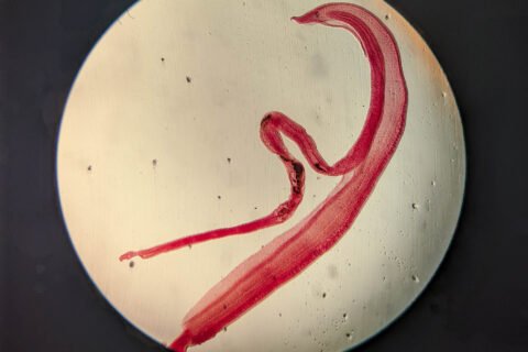 Diagnostic Breakthrough: How Laboratory Larval Development Confirmed Rare Parasitic Brain Infection